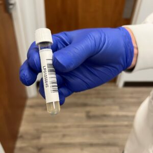 Plasma Samples from 500 Donors