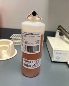 HBsAg Positive Plasma