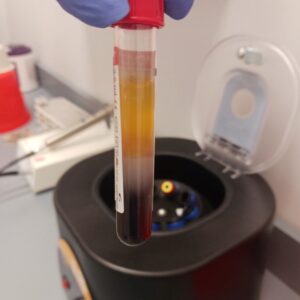 Serum Samples from 500 Donors